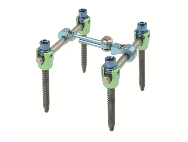 Understanding the Insert Spine Fixation Device – askanner